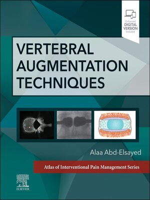 cover image of Vertebral Augmentation Techniques
